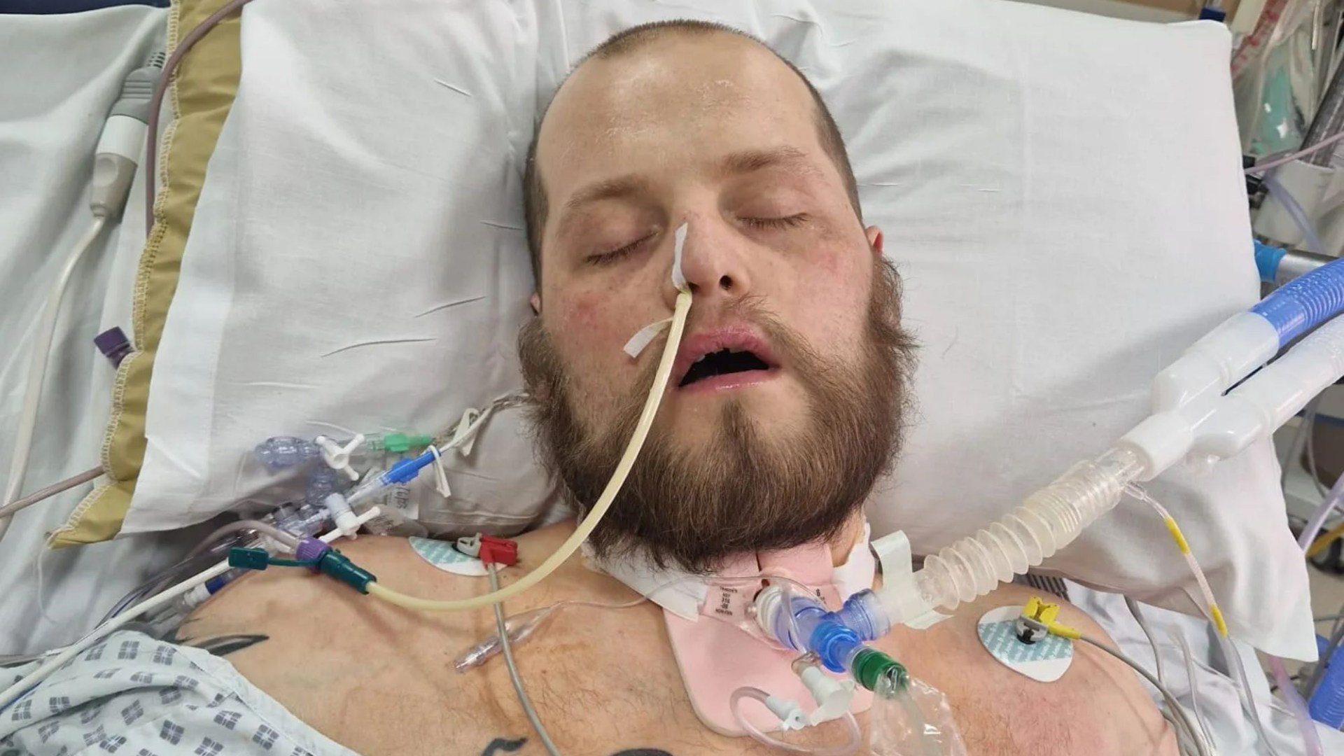 “Wonder guy”, 31 anni, è tornato in vita dopo che il suo cuore si è fermato per 50 minuti e i paramedici lo hanno colpito 17 volte